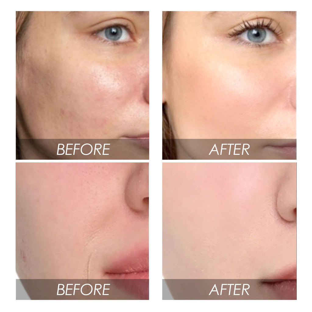 Avocado & Watermelon Facial Essence